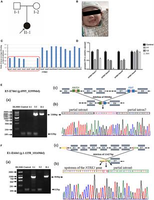 Novel Gross Deletion Mutations in NTRK1 Gene Associated With Congenital Insensitivity to Pain With Anhidrosis